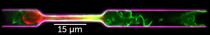 A mouse immune cell squeezes its cytoskeleton and nucleus as it squeezes through a microchannel with a tight squeeze.